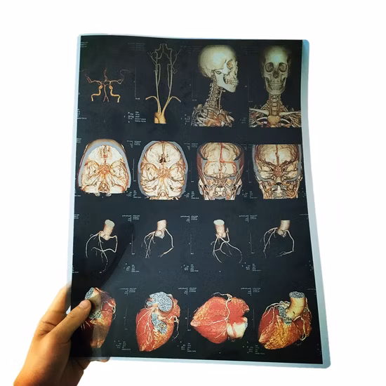 Film médical bleu de radiologie d'impression à jet d'encre de haute qualité
